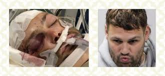 Does anyone have images from the murder of Peter Porco? He was fatally  attacked with an axe by his son but still managed his morning routine  before collapsing and dying. I just