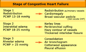 the radiology assistant chest x ray heart failure