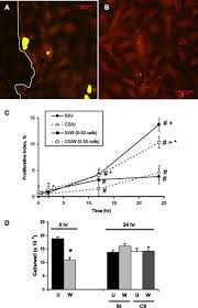 What animal cell organelles are represented well in makena?s model. Balance Of Life And Death In Alveolar Epithelial Type Ii Cells Proliferation Apoptosis And The Effects Of Cyclic Stretch On Wound Healing American Journal Of Physiology Lung Cellular And Molecular Physiology
