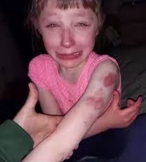 Lilly Waldron's Instagram, Twitter & Facebook