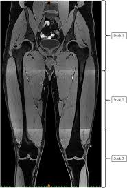 This article covers the anatomy of bones, their classification, functions and clinical aspects. Minimal Medical Imaging Can Accurately Reconstruct Geometric Bone Models For Musculoskeletal Models