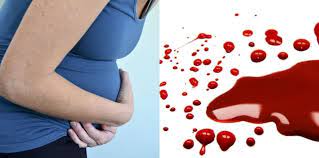 Saat hamil, keluar bercak flek darah merah atau coklat kadang terjadi. Flek Saat Hamil Kenali Mana Yang Normal Dan Berbahaya Theasianparent Indonesia