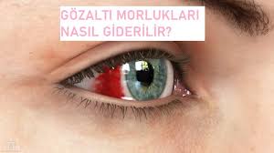 Gozalti Morluklari Icin Maske 2020 Genetik Deyisler Maskeler