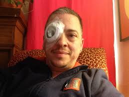 Help Artist eddie gesso Pay For Cataract Surgery by eddie gesso