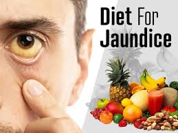 Diet For Jaundice Foods To Eat And Foods To Avoid Boldsky Com
