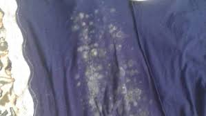 Removing mold from clothes with baking soda will have to be done in conjunction with white vinegar. How To Remove Mould From Clothes Prevent Mouldy Clothes Mouldgone Com