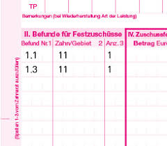 Hält die kasse die frist nicht ein, ohne den versicherungsnehmer über die verzögerung zu. Der Heil Und Kostenplan Fur Die Versorgung Mit Zahnersatz