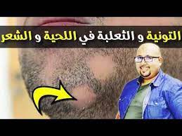 التخلص من الثعلبة و التونية في الشعر و القشرة الكثيرة مشاكل فروة الرأس مع الدكتور عماد ميزاب Youtube Pandora Screenshot