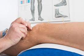 Maybe you would like to learn more about one of these? Akupunktur Schmerztherapie