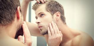 Male pattern baldness, she says. How To Prevent Hair Loss In Men