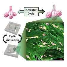 For example, breast cancer that has spread to the bones is called metastatic breast cancer, not bone. Understanding Breast Cancer Metastasis Through Novel Testing Platform Healthcare In Europe Com