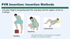This cycle the doctor prescribed progesterone pills vaginally 2x a day ( some women take the pr. Progesterone Vaginal Ring Pvr Session 1 Characteristics Of