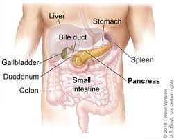 Pancreatic cancer symptoms and signs often do not manifest until the cancer has metastasized. Pancreatic Cancer Cancer Stat Facts