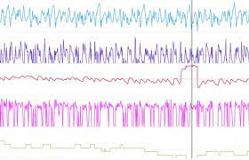 We did not find results for: The Czech Ondrej Cink Had To Get Off The Bike In Vallnord Because Of An Arrhythmia