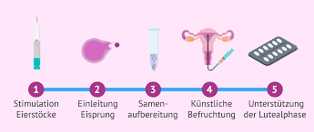Kunstliche Befruchtung Methoden Ablauf Kosten Und Risiken