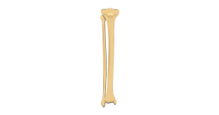 Transparent bones unlabeled transparent png clipart free download. Tibia And Fibula Bones Quiz Anterior Markings