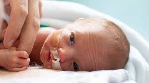 Image result for Preterm Infant Growth