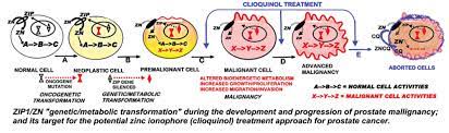 Breast cancer is the second most common cancer found in women — after skin cancer — but that doesn't mean men aren't at risk as well. Clinmed International Library Zinc Ionophore Clioquinol Inhibition Of Human Zip1 Deficient Prostate Tumor Growth In The Mouse Ectopic Xenograft Model A Zinc Approach For The Efficacious Treatment Of Prostate Cancer International