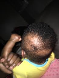 Looking for baby hair products that gently care for their delicate scalp? African American Baby Hair Glow Community