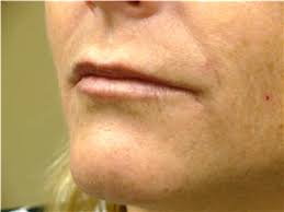 We staff a team of experts who will be happy to answer any questions, provide detailed technical specifications, or arrange a . Bellissima Medical Aesthetics Dieppe Nb 6 855 Boul Dieppe Canpages