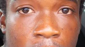 Tattoos lead to capture of suspect in frying-pan murder