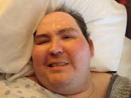 Fundraiser by Daniel Coon : Cancer Patient