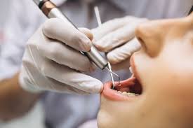 Meski makin banyak giginya yang rusak, masih kutunda saja dengan alasan tersebut. Kenali Periodontitis Penyakit Gigi Lepas Sendiri
