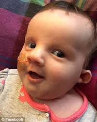 Baby girl dies month after stroke left her in a coma with family's dog  refusing to leave her