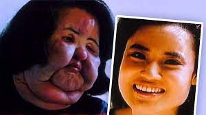 Können die spermien dann noch in die scheide gelangen wenn das wasser 'nach unten abfließt'? Arzt Verweigert Botox Frau Spritzt Sich Speiseol Ins Gesicht