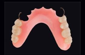 De guzman dental clinic dentist. A Guide To Types Of Partial Dentures And Costs Stomadent