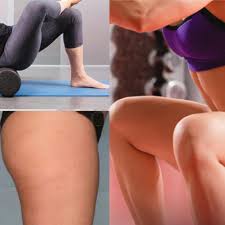 Cellulite occurs when you have too much body fat and not enough muscle. 7 Natural Home Remedies To Get Rid Of Cellulite Fast