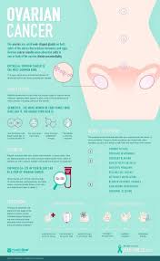 Ovarian cancer is a type of cancer that begins in the ovaries. Pin On Ovarian Cancer