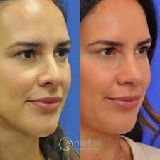Mehta Plastic Surgery added a new...