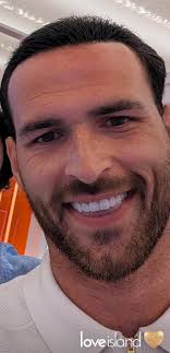 Ronnie hair question : r/LoveIslandTV