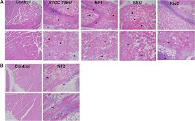 Even today, this often polymicrobial infection still carries a high mortality rate and continues to be a. Functional Genomic Characterization Of Virulence Factors From Necrotizing Fasciitis Causing Strains Of Aeromonas Hydrophila Applied And Environmental Microbiology