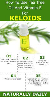 Pin On Essential Oils Natural Remedies