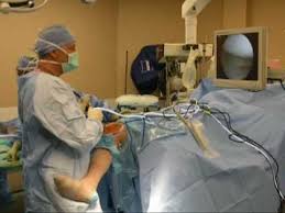 If you've experienced a meniscal tear and are planning to have surgery to repair it, keep reading for more information on how surgery is typically most effective for younger individuals who have experienced an acute meniscal tear. Inside The Operating Room For A Meniscus Repair Surgery Youtube Arthroscopic Knee Surgery Knee Surgery Recovery Knee Surgery