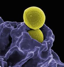 Maybe you would like to learn more about one of these? Which Organelle Contains Enzymes For Intracellular Digestion Study Com