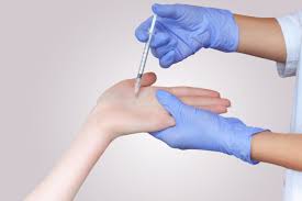 How long does it take for botox to work for sweating. Botox For Sweating Vida Wellness And Beauty At Tijuana