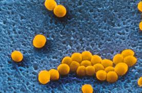 Infecția cu stafilococ auriu nu este de neglijat. Stafilococul Auriu Care Este Tratamentul Care Te ScapÄƒ De InfecÈ›ie