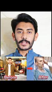 Aymen Ali Death Reason