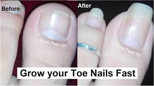 So, we'll start with the bad news: How To Grow Toe Nails Healthy And Fast Important Steps Toenail Growth Journey Rose Pearl Youtube