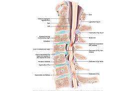 Image result for Spinal Trauma