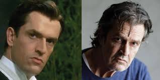 Rupert Everett Plastic Surgery Before and After Pictures 2025