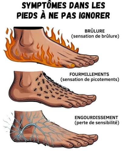 SYMPTÔMES DANS LES PIEDS À NE PAS IGNORER Par les pieds le corps exprime  des signaux pouvant révéler un déséquilibre ou un problème sous-jacent.  🔥🔥 SENSATION DE BRÛLURE : impression de chaleur