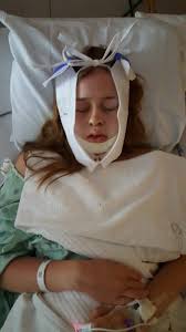 Wisdom teeth usually make an appearance between the ages of 17 and 21 or even older. How To Reduce Swelling After Wisdom Teeth Removal Arxiusarquitectura