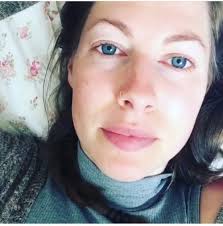 Lyme Disease: Woman Reveals How One Tiny Tick Bite Ruined Her Life