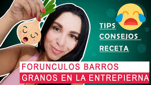 Forunculos Barros Y Granos En La Entrepierna Youtube
