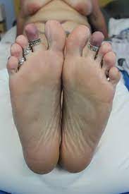 Phoenix stacy feet