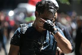 The recent assault is the second time ngo was brutalized by antifa militants in the rose city. Conservative Writer Andy Ngo Details Attack At Portland Protest Oregonlive Com